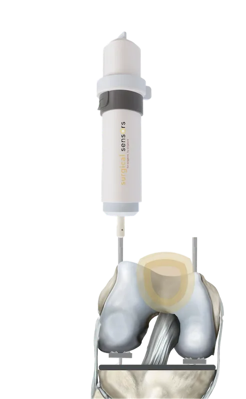 The balanSScer knee-balancing sensor by Surgical Sensors